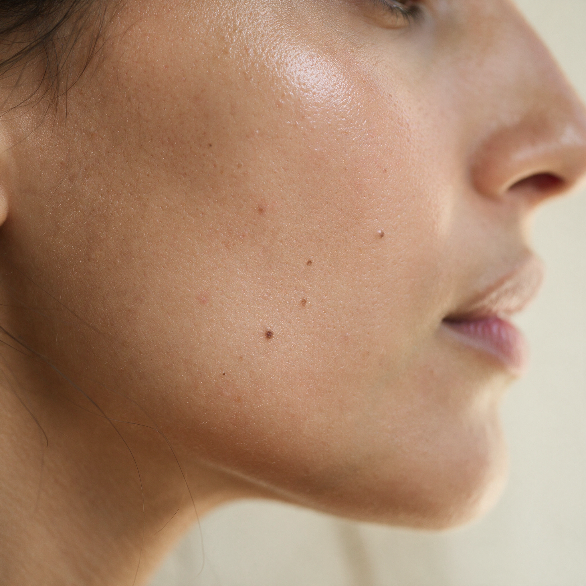 Macro detail of calm, even, hydrated skin after eight weeks of the full Lyquora routine